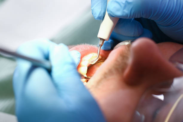 Best Tooth Infection Emergency Dentist  in Reno, TX
